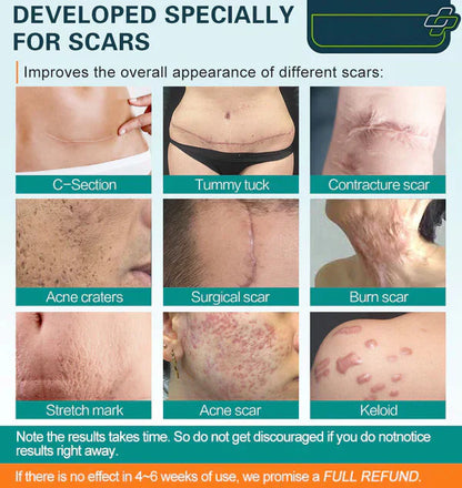 ❤️ ScarRemove™ Advanced Scar Spray For All Types of Scars - For example Acne Scars. Surgical Scars and Stretch Marks ⚡️⚡️⚡️ - Smart Shop (Online Store for wise shoppers) )