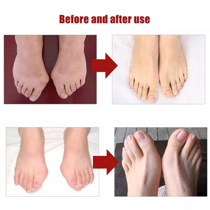 Silicone Toes Valgus Corrector - Smart Shop (Online Store for wise shoppers) 