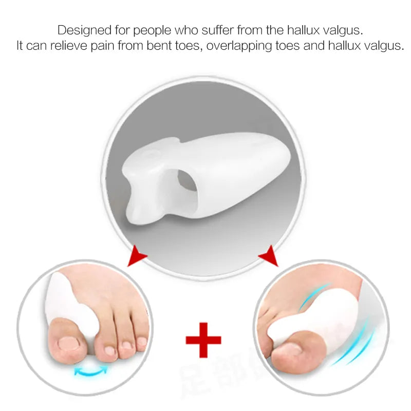 Silicone Toes Valgus Corrector - Smart Shop (Online Store for wise shoppers) 