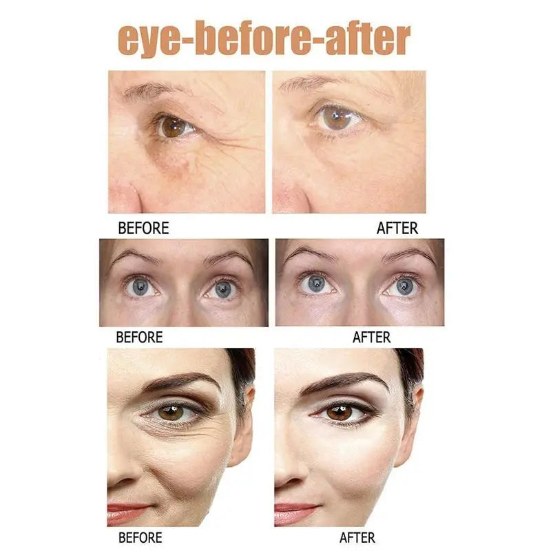 Instant Eye Bag Removal - Smart Shop (Online Store for wise shoppers) 