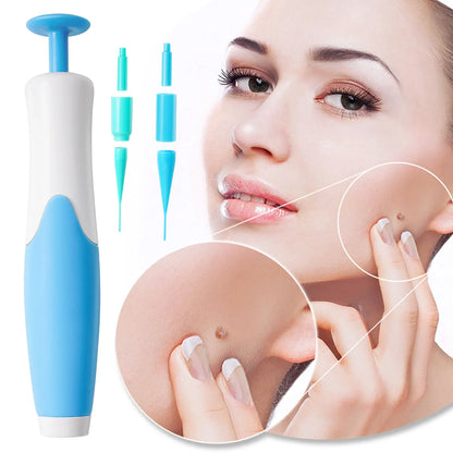 Skin Tag Removal Kit - Smart Shop (Online Store for wise shoppers) 