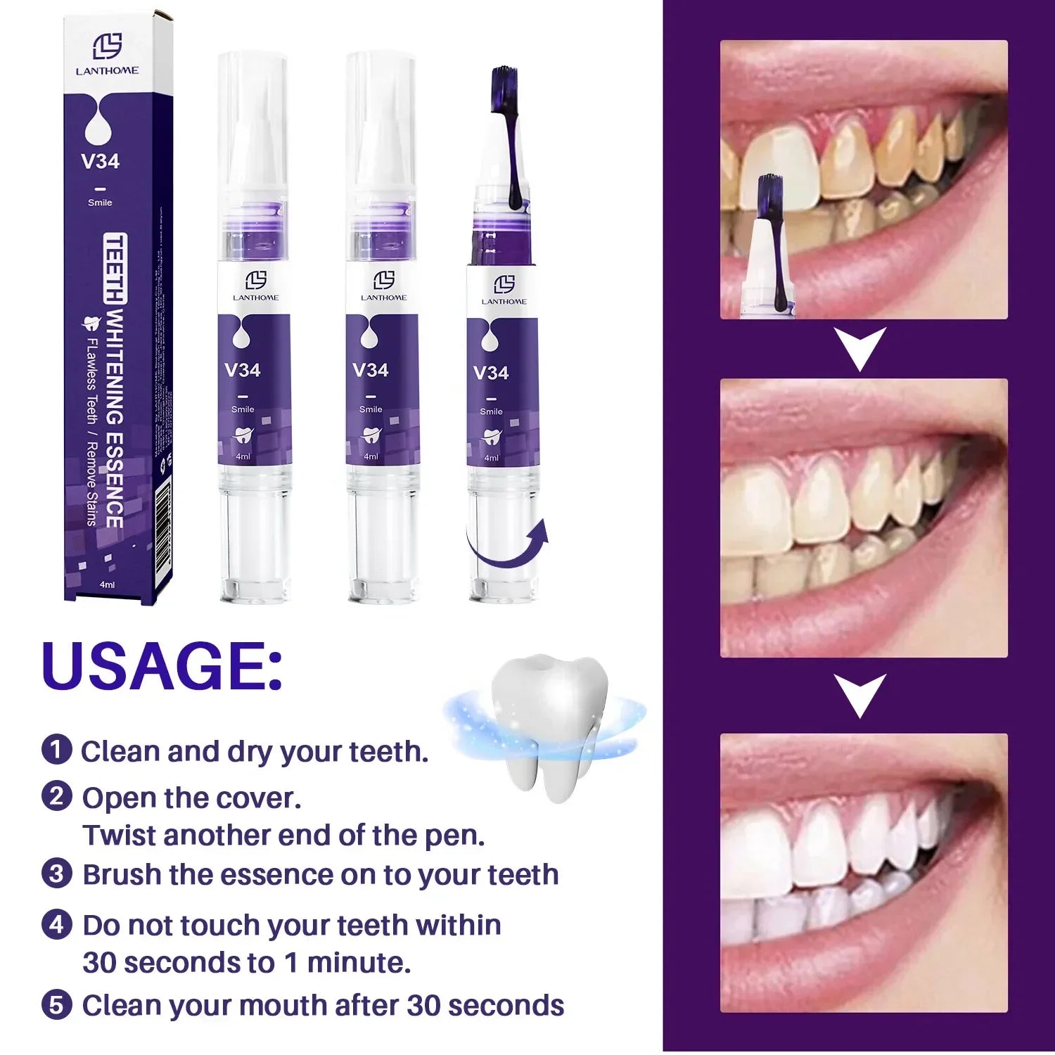 Whitening Dental Gel Pen - Smart Shop (Online Store for wise shoppers) )