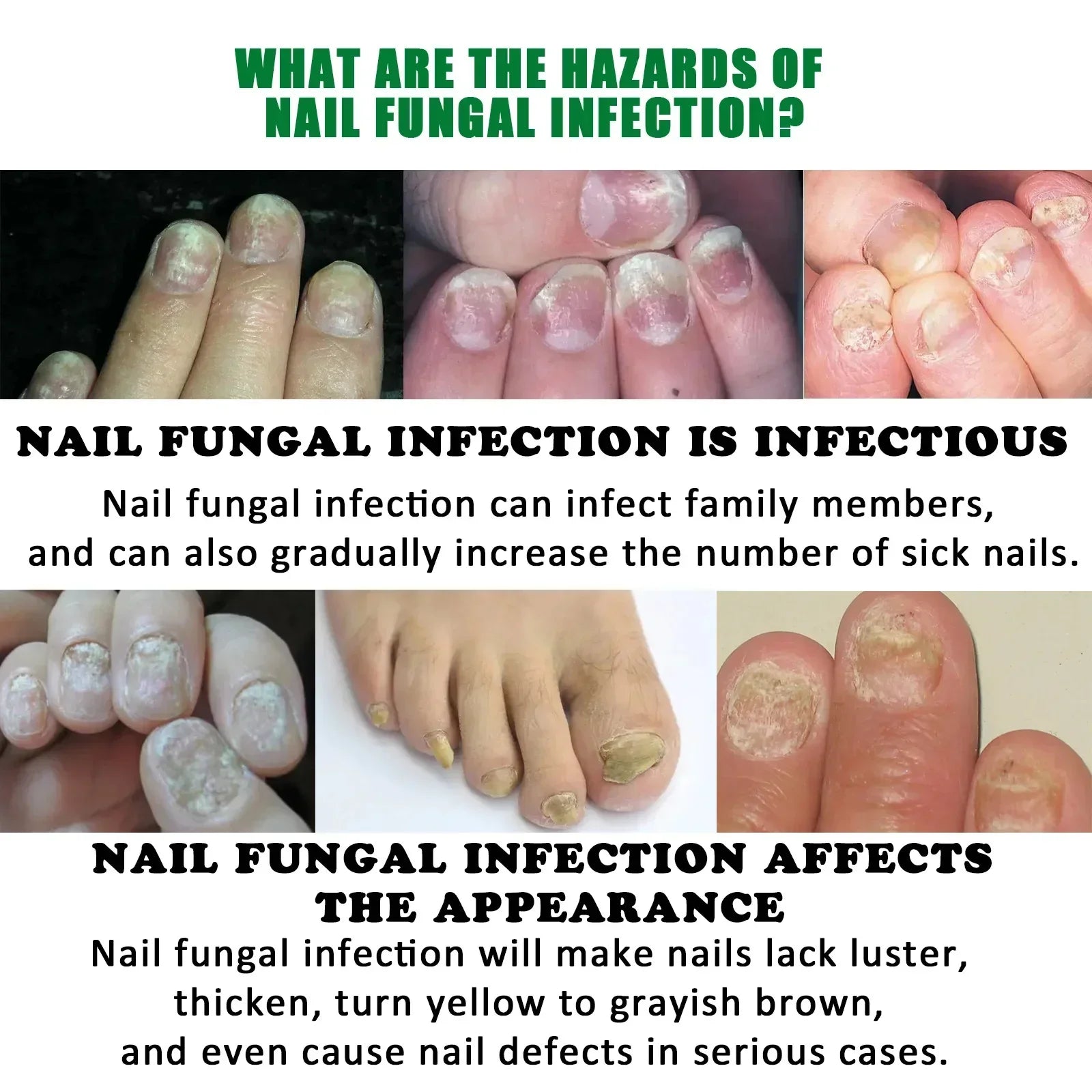 Nail Fungus Defender Serum - Smart Shop (Online Store for wise shoppers) 