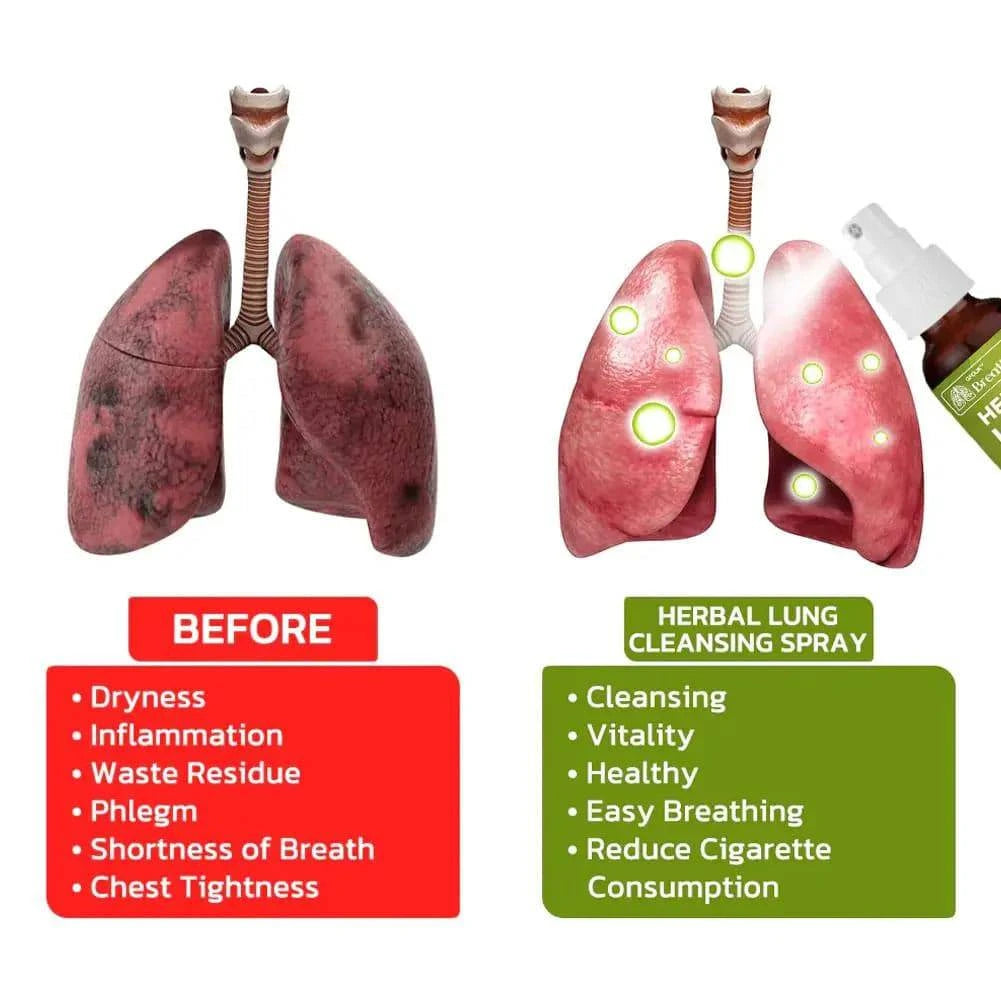 FreshLung™ - Breath Detox Herbal Lung Cleansing Spray - Smart Shop (Online Store for wise shoppers) 