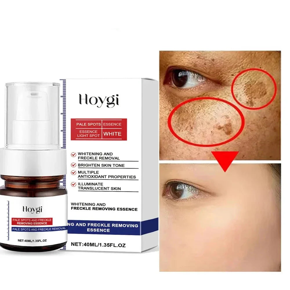 Moisturizing Dark Spots Remover - Smart Shop (Online Store for wise shoppers) 