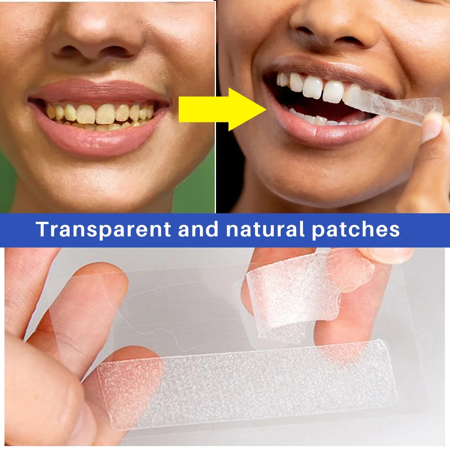 Teeth Whitening Strips - Smart Shop (Online Store for wise shoppers) 