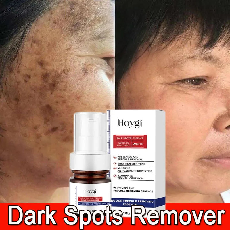 Moisturizing Dark Spots Remover - Smart Shop (Online Store for wise shoppers) 