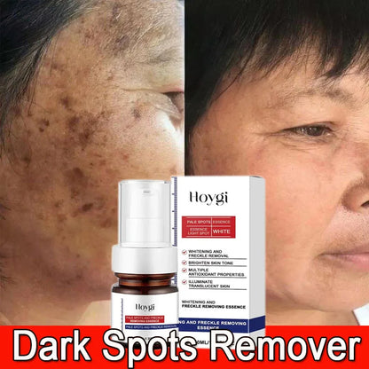 Moisturizing Dark Spots Remover - Smart Shop (Online Store for wise shoppers) 