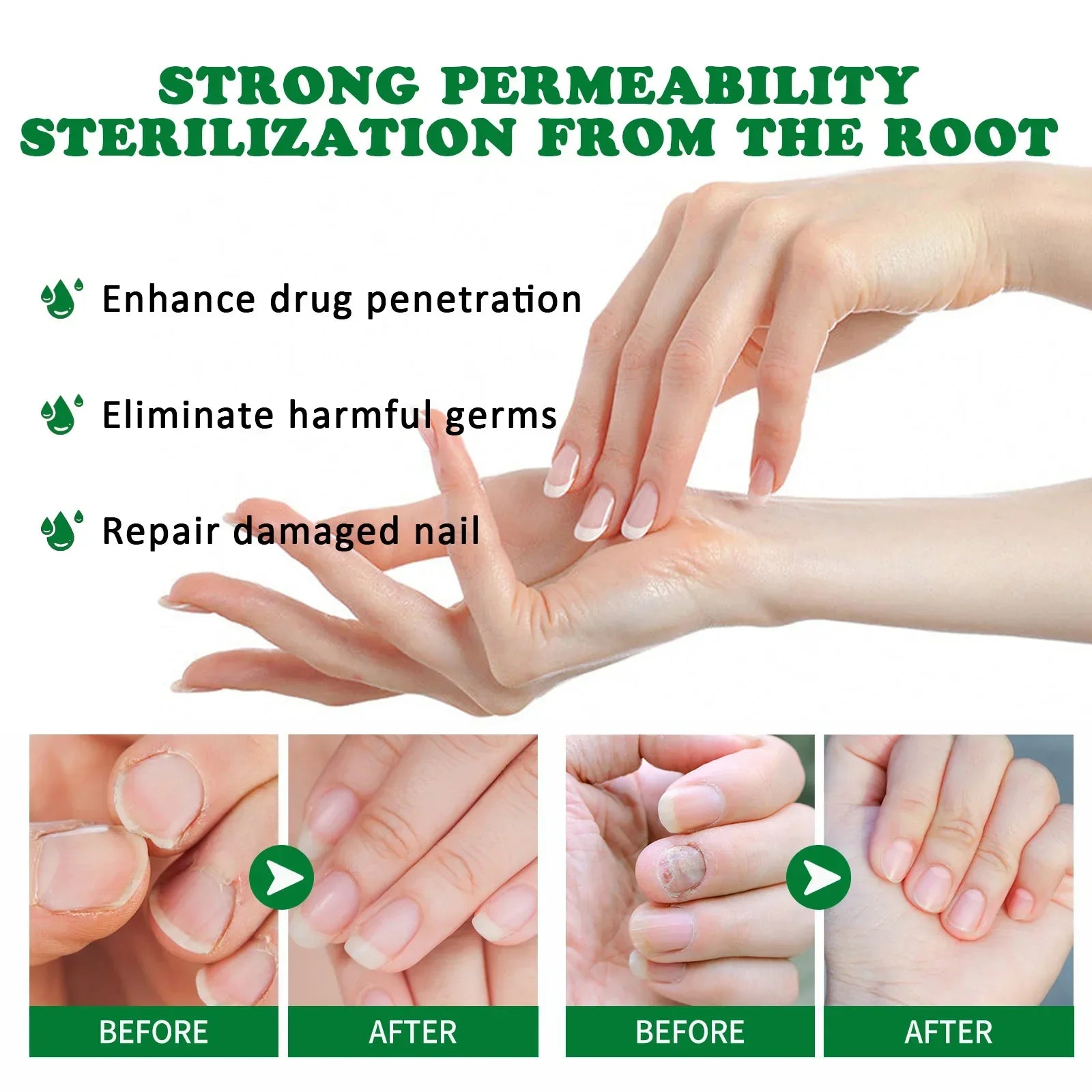 Nail Fungus Defender Serum - Smart Shop (Online Store for wise shoppers) 