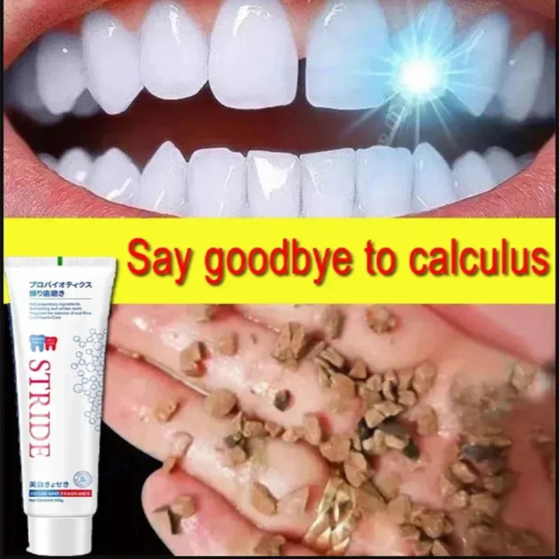 Dental Calculus Removing Toothpaste - Smart Shop (Online Store for wise shoppers) 