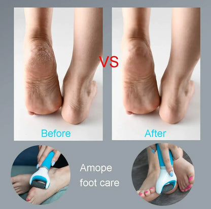 USB Foot Callus Remover Pedicure Tool - Smart Shop (Online Store for wise shoppers) 