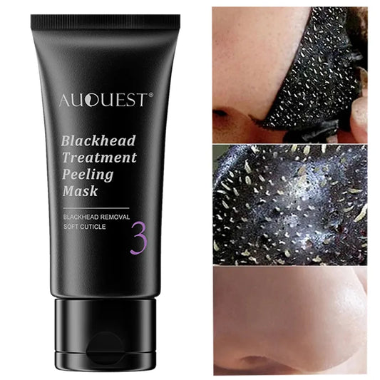 Cleanuest™ - Blackhead Remover Mask - Smart Shop (Online Store for wise shoppers) )