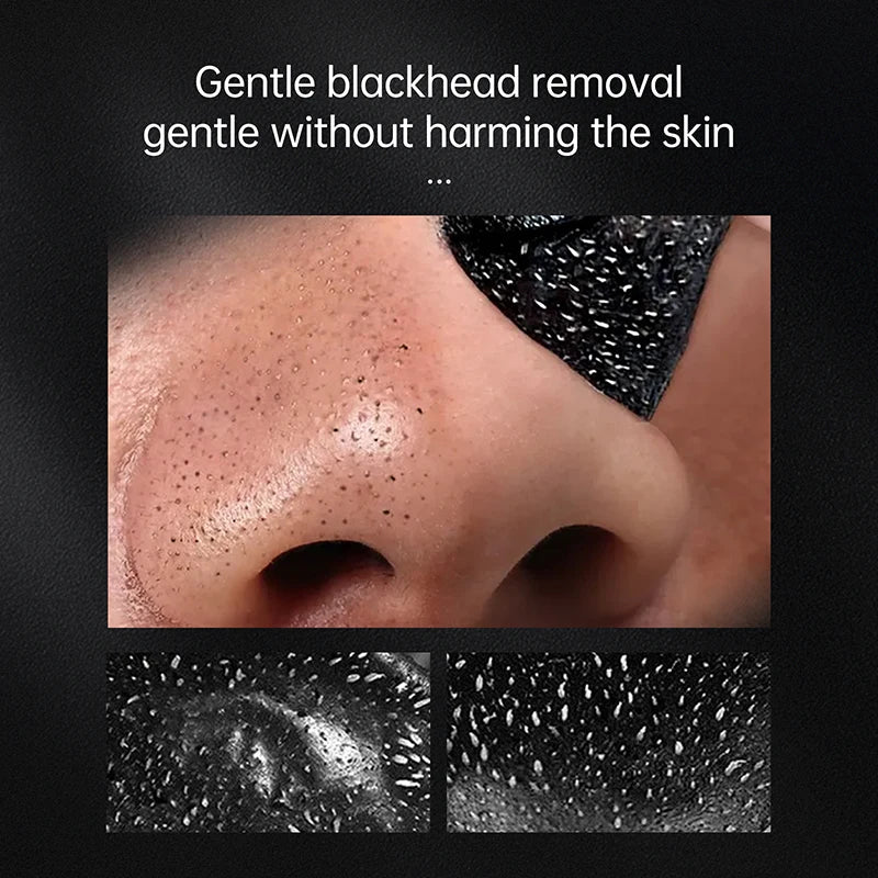 Cleanuest™ - Blackhead Remover Mask - Smart Shop (Online Store for wise shoppers) )