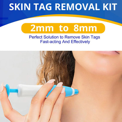 Skin Tag Removal Kit - Smart Shop (Online Store for wise shoppers) 