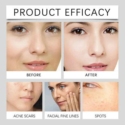 Moisturizing Dark Spots Remover - Smart Shop (Online Store for wise shoppers) 