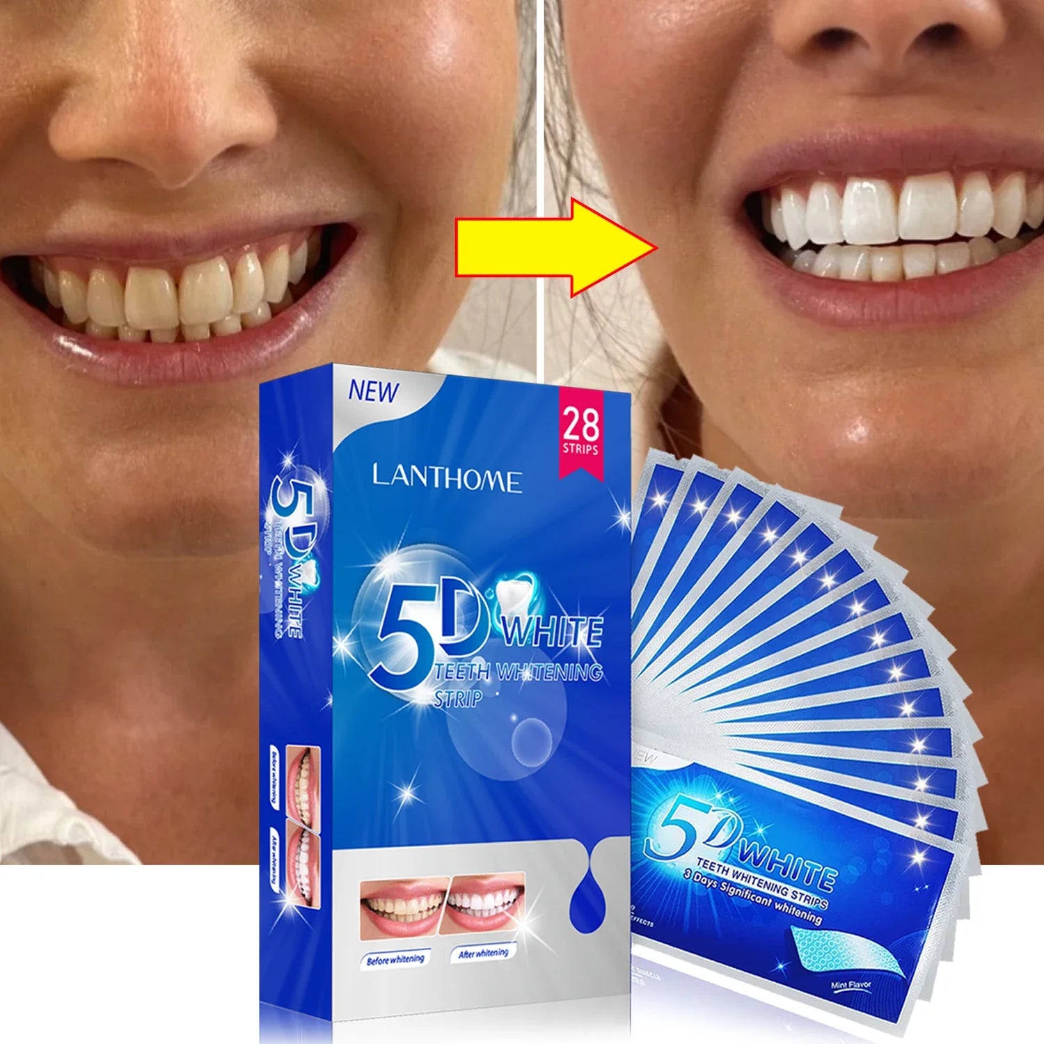 Teeth Whitening Strips - Smart Shop (Online Store for wise shoppers) 