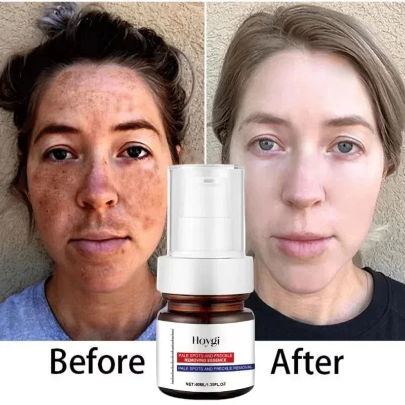 Moisturizing Dark Spots Remover - Smart Shop (Online Store for wise shoppers) 