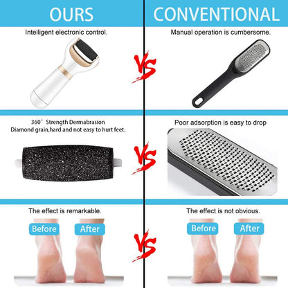 USB Foot Callus Remover Pedicure Tool - Smart Shop (Online Store for wise shoppers) 