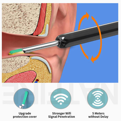 Wireless Endoscope HD Ear Pick Set - Smart Shop (Online Store for wise shoppers) 