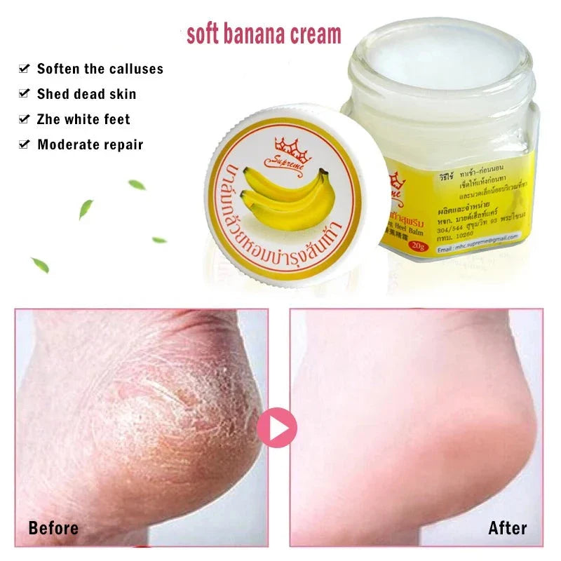 Dead Skin Remover Crack Cream - Smart Shop (Online Store for wise shoppers) 