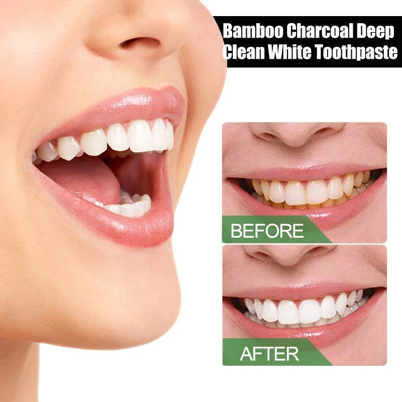 Bamboo Charcoal Teeth Whitening Toothpaste - Smart Shop (Online Store for wise shoppers) 