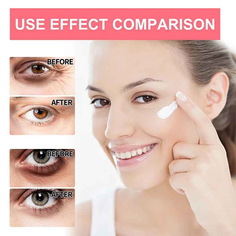 Anti Wrinkle Eye Bag Remover Cream - Smart Shop (Online Store for wise shoppers) 