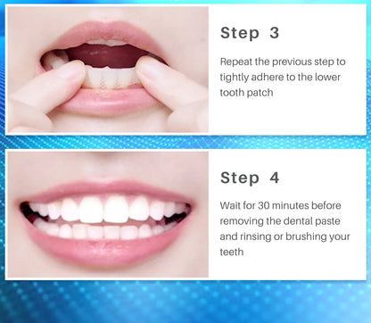 Teeth Whitening Strips - Smart Shop (Online Store for wise shoppers) 