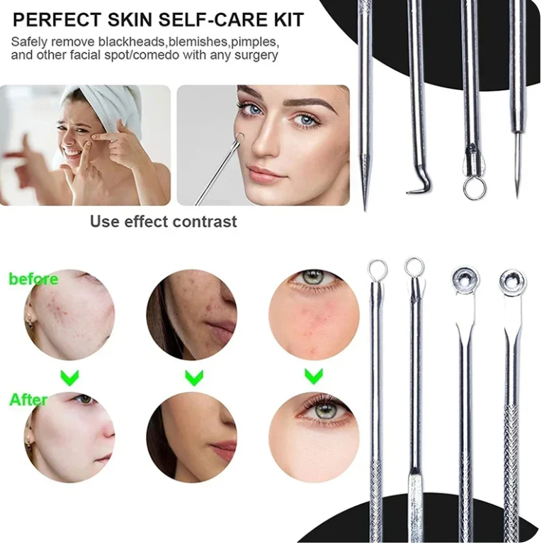 Ultra-Fine™ -Acne Blackhead Removal Kit - Smart Shop (Online Store for wise shoppers) )