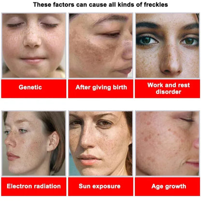 Moisturizing Dark Spots Remover - Smart Shop (Online Store for wise shoppers) 