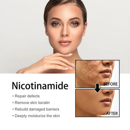 🔥Last Day Promotion 64% OFF-Niacinamide Facial Essence💖 - Smart Shop (Online Store for wise shoppers) )