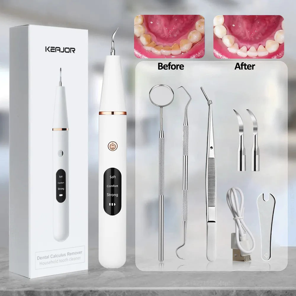 Electric Dental Calculus Remover - Smart Shop (Online Store for wise shoppers) 