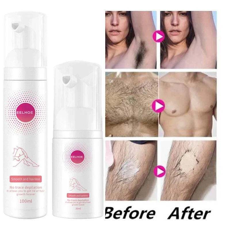 Foam Hair Removal Spray - Smart Shop (Online Store for wise shoppers) 