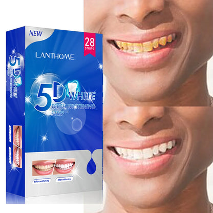 Teeth Whitening Strips - Smart Shop (Online Store for wise shoppers) 