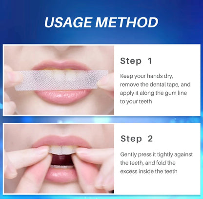 Teeth Whitening Strips - Smart Shop (Online Store for wise shoppers) 