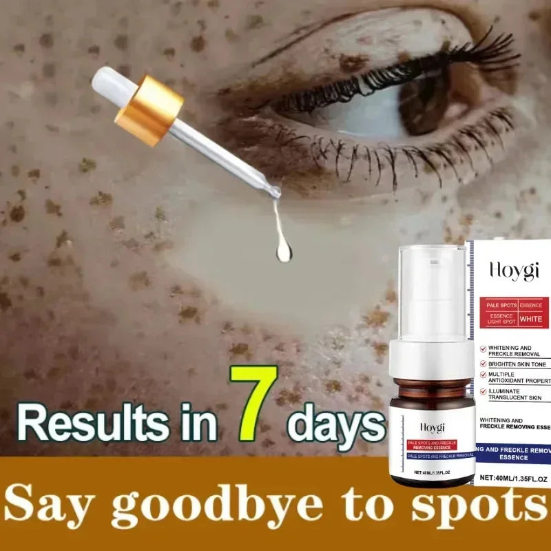 Moisturizing Dark Spots Remover - Smart Shop (Online Store for wise shoppers) 