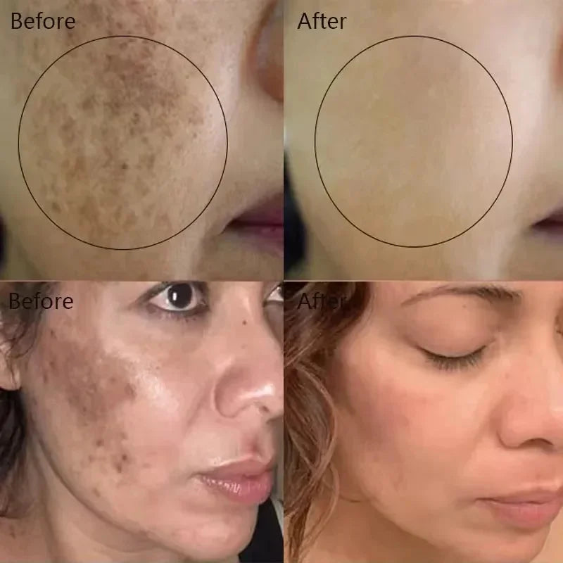 Moisturizing Dark Spots Remover - Smart Shop (Online Store for wise shoppers) 