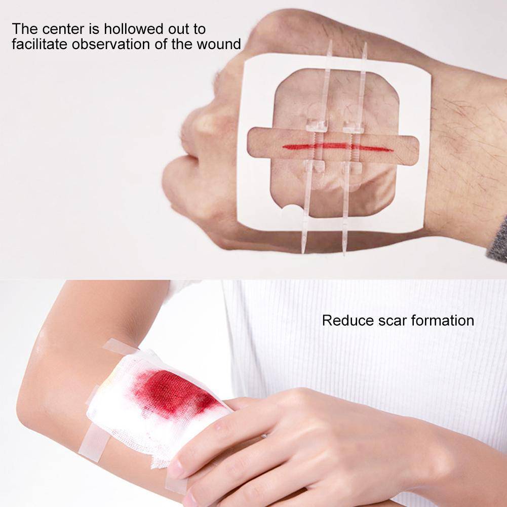 AdhesiveZipper ™ - Zipper Band First-Aid Kit - TumTum