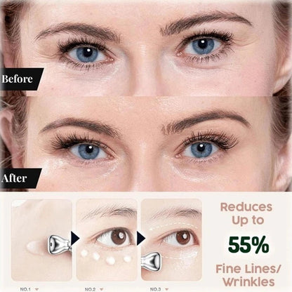 Anti-Wrinkle Eye Cream - Smart Shop (Online Store for wise shoppers) )