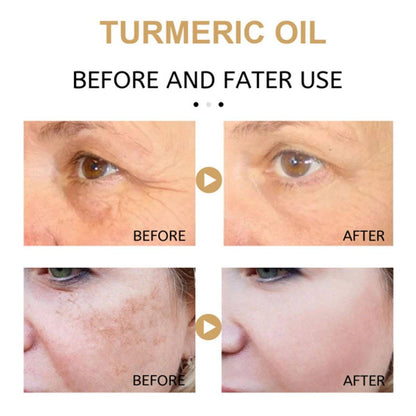 AntiAging ™ - Turmeric Dark Spot Corrector Serum - Smart Shop (Online Store for wise shoppers) 