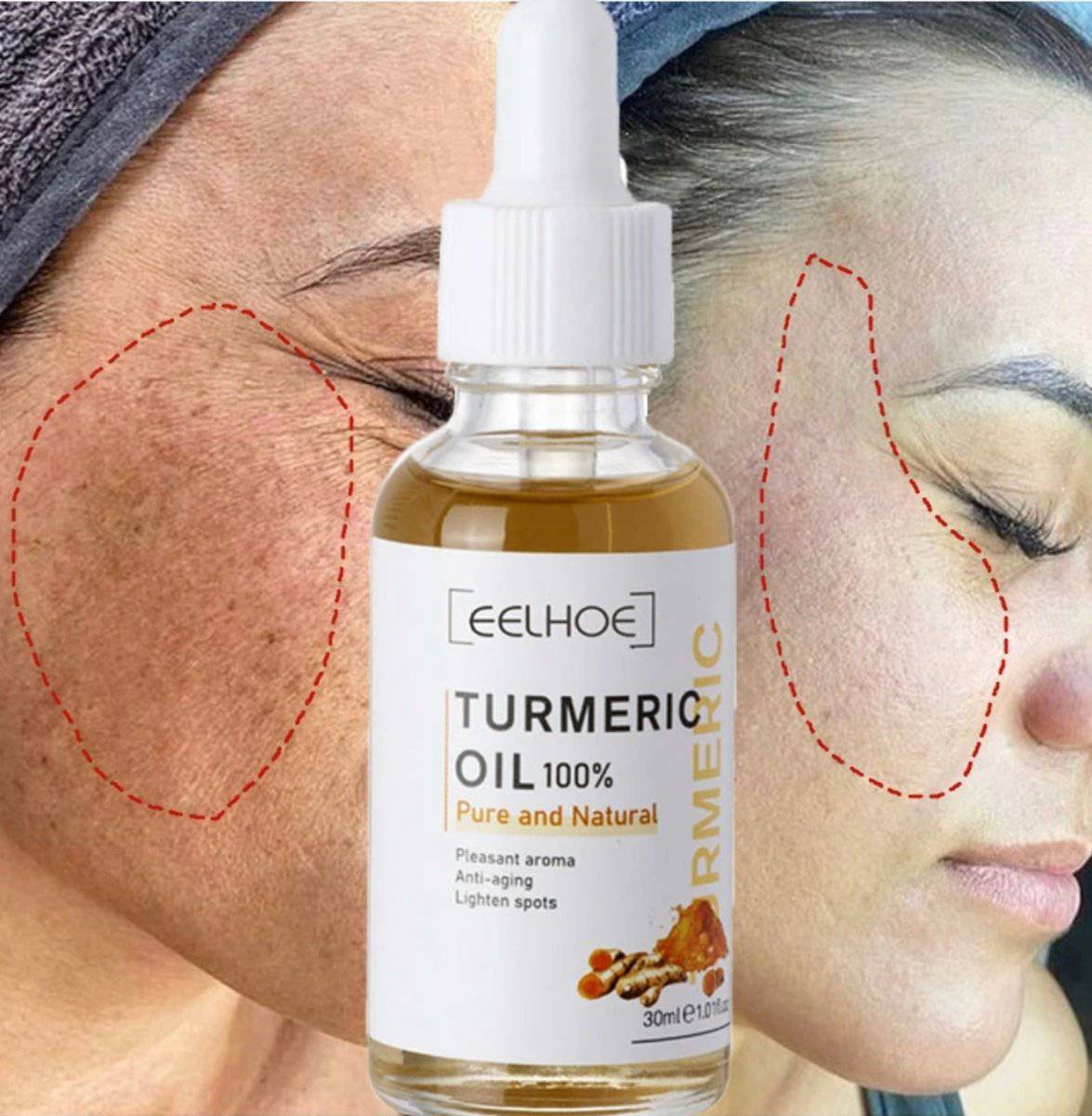 AntiAging ™ - Turmeric Dark Spot Corrector Serum - TumTum