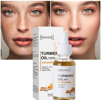 AntiAging ™ - Turmeric Dark Spot Corrector Serum - Smart Shop (Online Store for wise shoppers) 