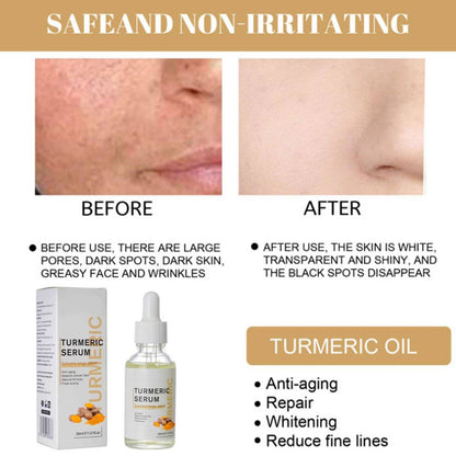 AntiAging ™ - Turmeric Dark Spot Corrector Serum - Smart Shop (Online Store for wise shoppers) 