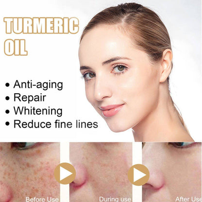 AntiAging ™ - Turmeric Dark Spot Corrector Serum - Smart Shop (Online Store for wise shoppers) 