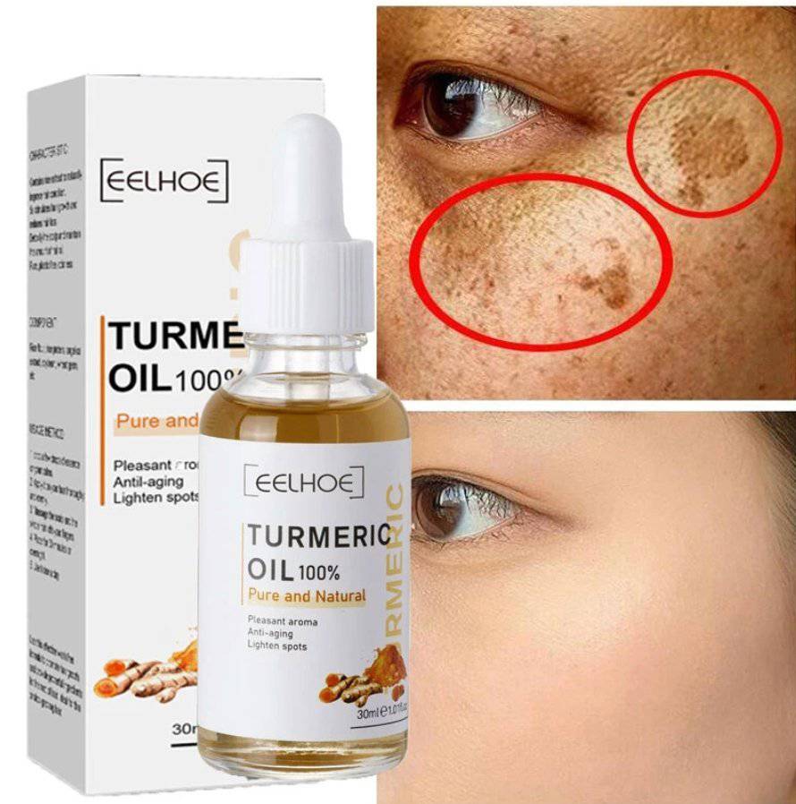 AntiAging ™ - Turmeric Dark Spot Corrector Serum - Smart Shop (Online Store for wise shoppers) 