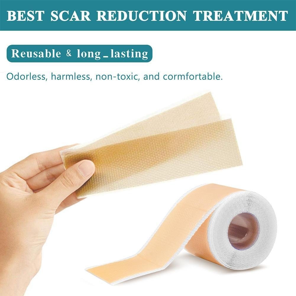 ELAIMEI™ Medical Soft Silicone Gel Tape for Scar Removal (1.6” x 60”） - Smart Shop (Online Store for wise shoppers) )