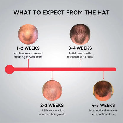 Megelin LED Laser Cap For Hair Growth - Megelin