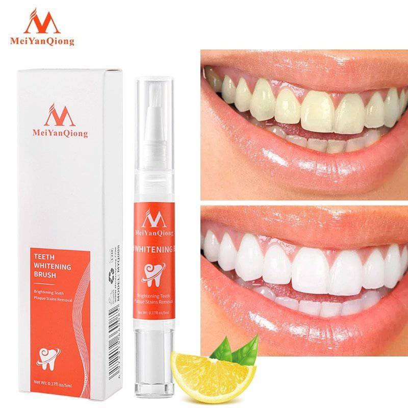 HeySmile ™ - Teeth Whitening Pen - Smart Shop (Online Store for wise shoppers) 