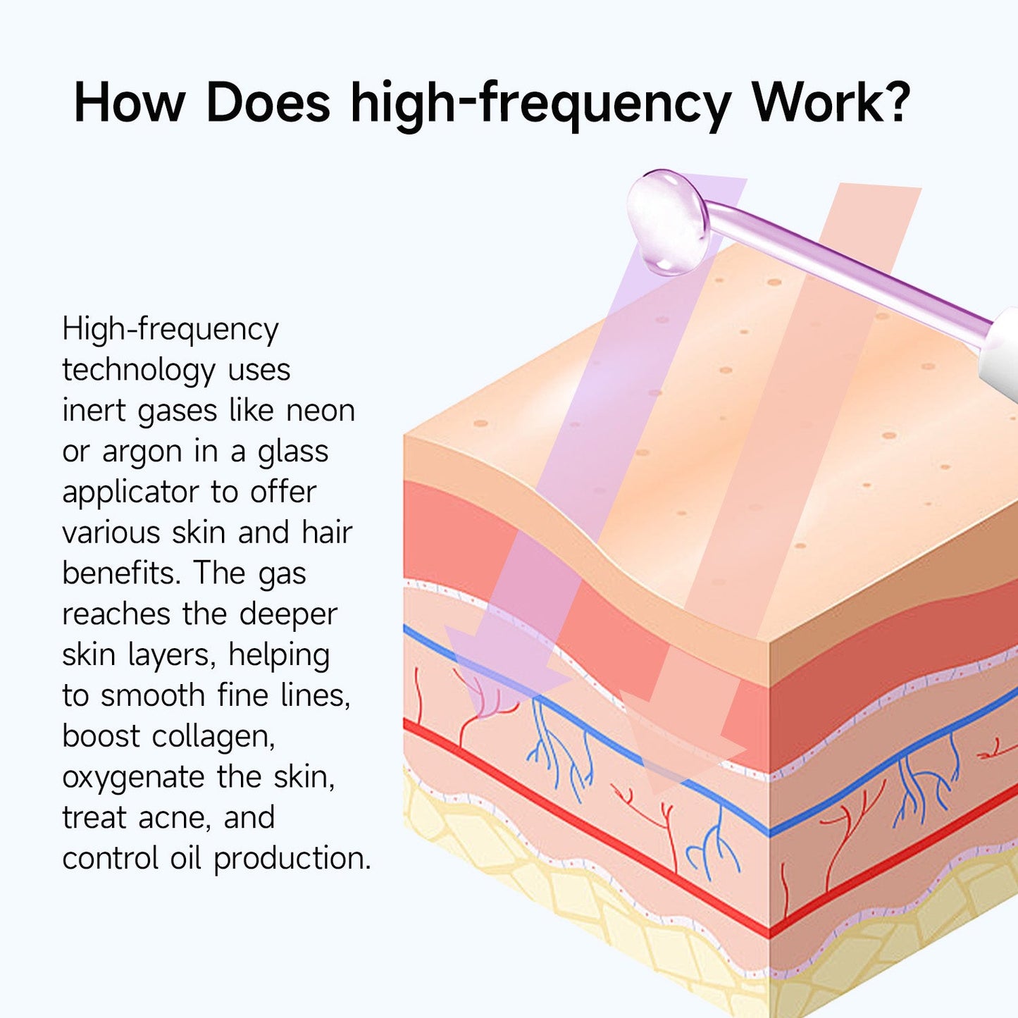 Megelin High Frequency Wand