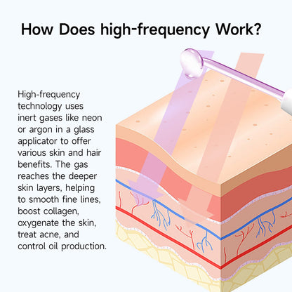 Megelin High Frequency Wand