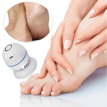 Electric Dead Skin Remover